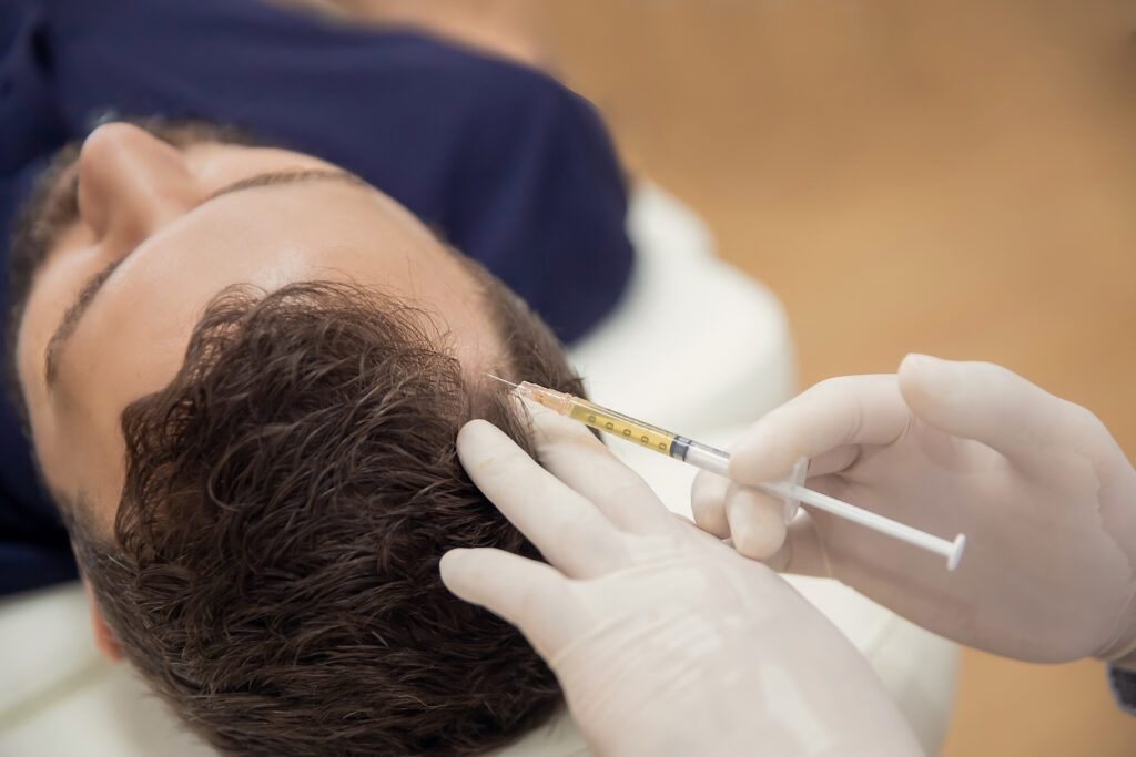 A Man getting hair restoration treatment | Jennmarie Medspa in Schaumburg, IL